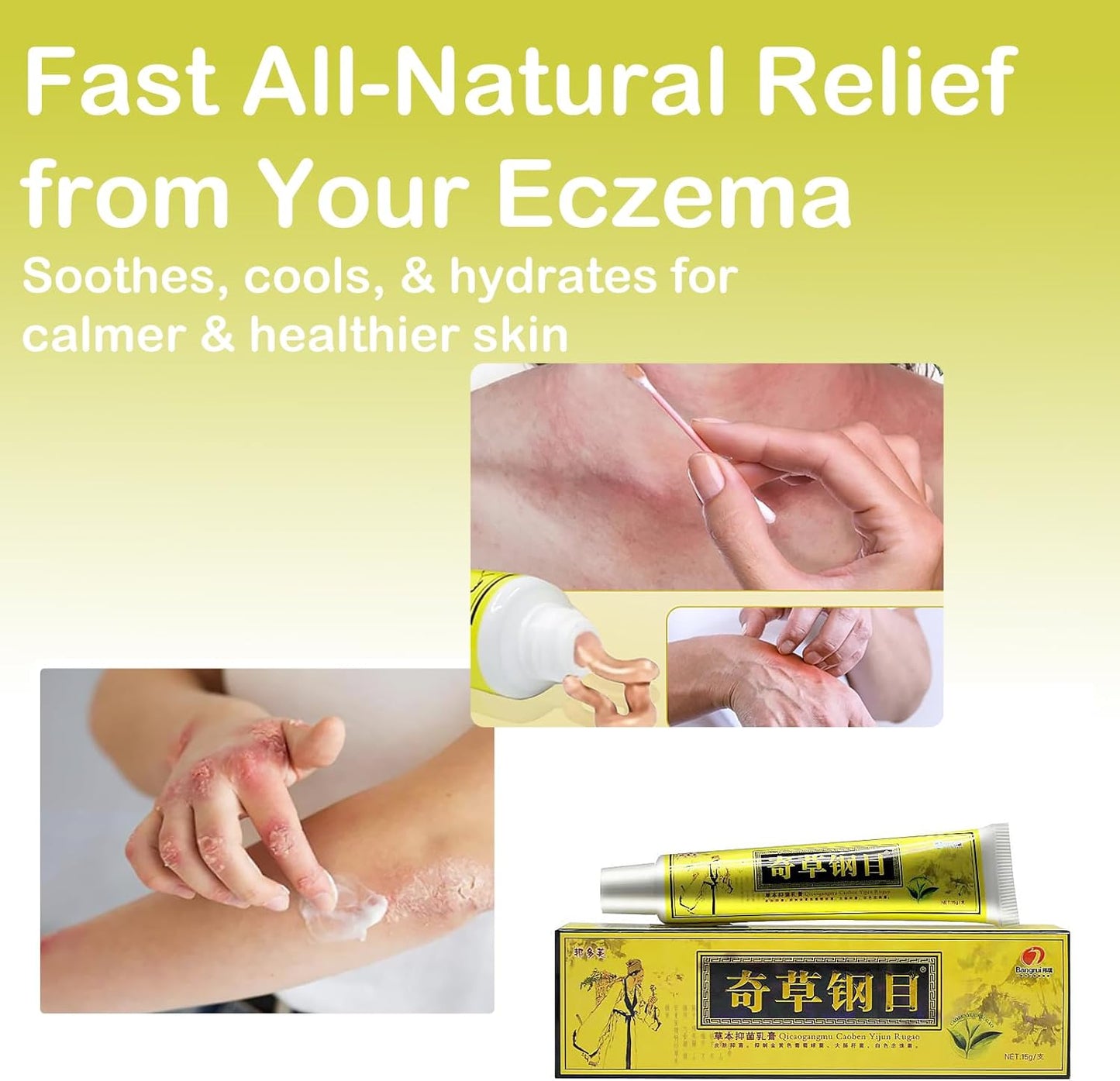 Natural Herbal Psoriasis Cream - Chinese Herbal Cream - 5 Pack