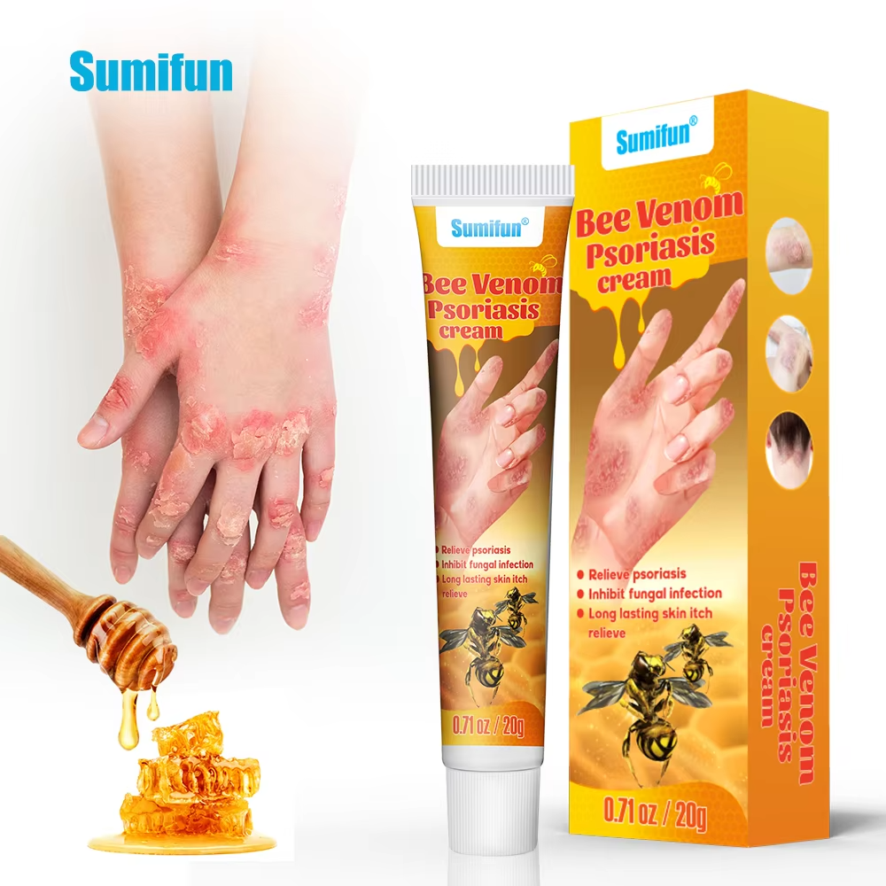 Bee Venom Psoriasis Cream Dermatitis Pruritus Eczema Ointment