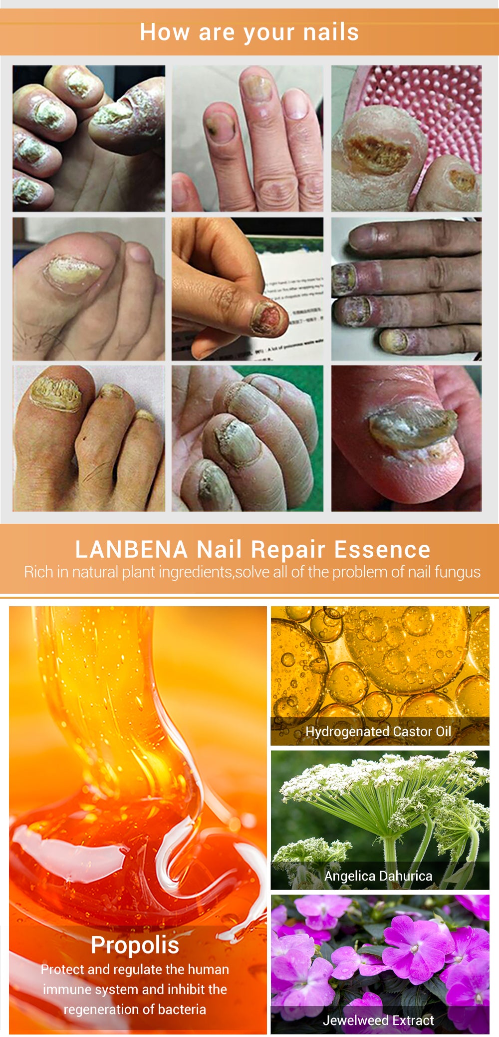 Lanbena Nail Repair Essence Serum 12ml